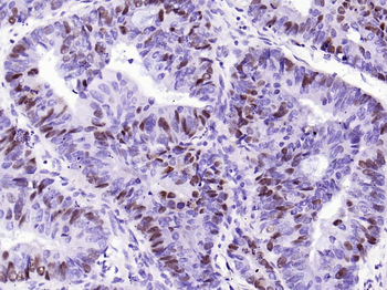 Phospho-Rb (Ser807) Recombinant Rabbit Monoclonal Antibody