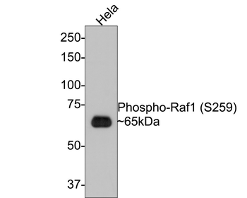 Phospho-RAF1 (Ser259) Recombinant Rabbit Monoclonal Antibody