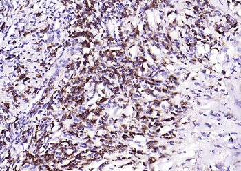 Phospho-PKR (Thr446) Recombinant Rabbit Monoclonal Antibody