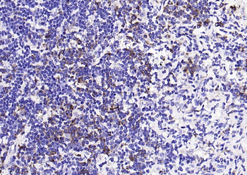 Phospho-PKR (Thr446) Recombinant Rabbit Monoclonal Antibody