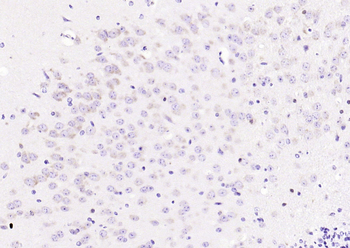 Phospho-PKR (Thr446) Recombinant Rabbit Monoclonal Antibody