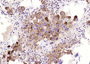 Phospho-PKR (Thr446) Recombinant Rabbit Monoclonal Antibody