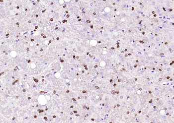 Phospho-PKR (Thr446) Recombinant Rabbit Monoclonal Antibody