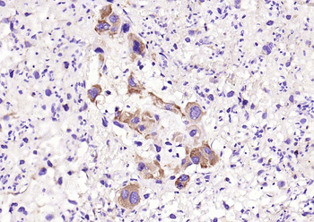 Phospho-PKR (Thr446) Recombinant Rabbit Monoclonal Antibody