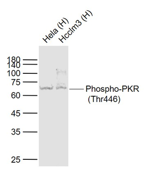Phospho-PKR (Thr446) Recombinant Rabbit Monoclonal Antibody