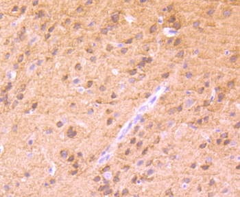 Phospho-PKC alpha (Thr638) Recombinant Rabbit Monoclonal Antibody
