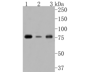 Phospho-PKC alpha (Thr638) Recombinant Rabbit Monoclonal Antibody