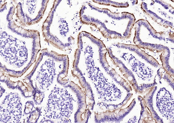 Villin Recombinant Rabbit Monoclonal Antibody