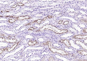 Villin Recombinant Rabbit Monoclonal Antibody