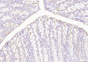 Villin Recombinant Rabbit Monoclonal Antibody