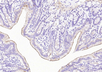Villin Recombinant Rabbit Monoclonal Antibody