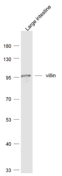 Villin Recombinant Rabbit Monoclonal Antibody