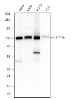 STAT5b Recombinant Rabbit Monoclonal Antibody