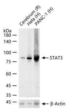 STAT3 Recombinant Rabbit Monoclonal Antibody