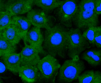 STAT2 Recombinant Rabbit Monoclonal Antibody