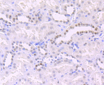 Histone H3 (acetyl K14) Recombinant Rabbit Monoclonal Antibody