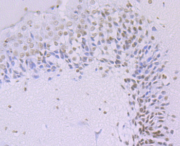 Histone H3 (acetyl K14) Recombinant Rabbit Monoclonal Antibody