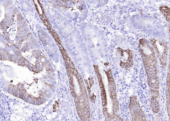 AGR2 Recombinant Rabbit Monoclonal Antibody