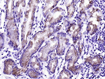 AGR2 Recombinant Rabbit Monoclonal Antibody