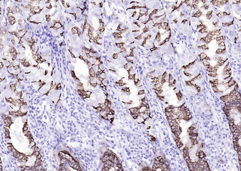 AGR2 Recombinant Rabbit Monoclonal Antibody