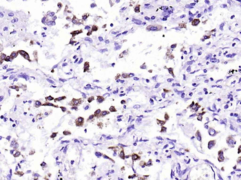 AGR2 Recombinant Rabbit Monoclonal Antibody