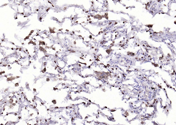 AGR2 Recombinant Rabbit Monoclonal Antibody