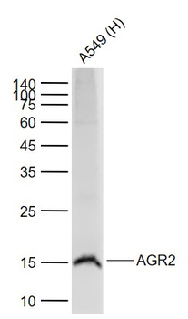 AGR2 Recombinant Rabbit Monoclonal Antibody