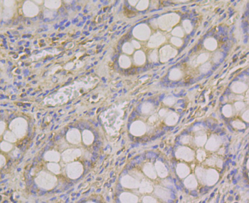 ADAMTS13 Recombinant Rabbit Monoclonal Antibody