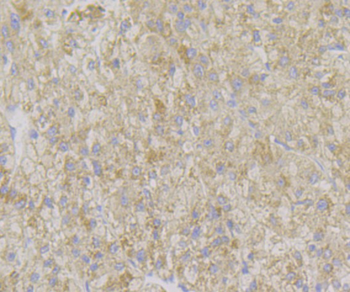 ADAMTS13 Recombinant Rabbit Monoclonal Antibody