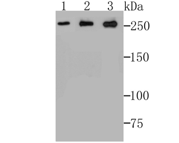 ADAMTS13 Recombinant Rabbit Monoclonal Antibody