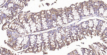 Sodium Potassium ATPase Recombinant Rabbit Monoclonal Antibody