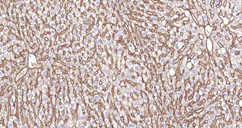 Sodium Potassium ATPase Recombinant Rabbit Monoclonal Antibody