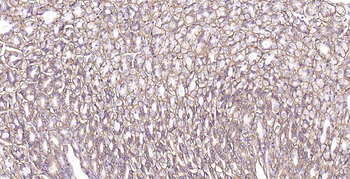 Sodium Potassium ATPase Recombinant Rabbit Monoclonal Antibody