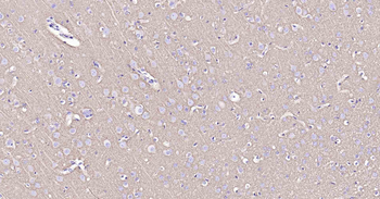 Sodium Potassium ATPase Recombinant Rabbit Monoclonal Antibody