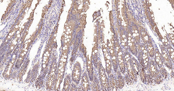 Sodium Potassium ATPase Recombinant Rabbit Monoclonal Antibody
