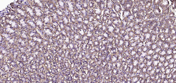 Sodium Potassium ATPase Recombinant Rabbit Monoclonal Antibody