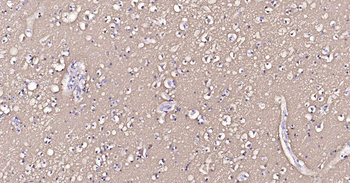 Sodium Potassium ATPase Recombinant Rabbit Monoclonal Antibody