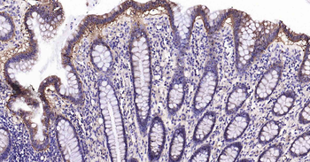 Sodium Potassium ATPase Recombinant Rabbit Monoclonal Antibody