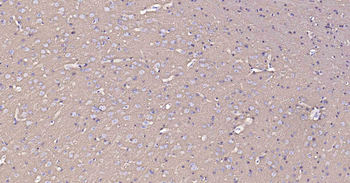 Sodium Potassium ATPase Recombinant Rabbit Monoclonal Antibody