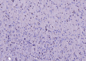 ACACA Recombinant Rabbit Monoclonal Antibody