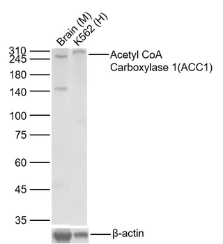 ACACA Recombinant Rabbit Monoclonal Antibody