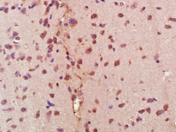 PIK3R1 Mouse Monoclonal Antibody