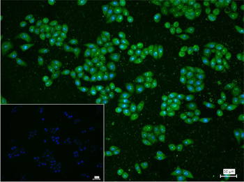 PI3-kinase p110 subunit beta Recombinant Rabbit Monoclonal Antibody