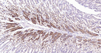 PI3-kinase p110 subunit beta Recombinant Rabbit Monoclonal Antibody