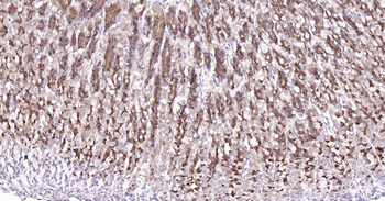 PI3-kinase p110 subunit beta Recombinant Rabbit Monoclonal Antibody