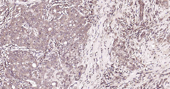 PI3-kinase p110 subunit beta Recombinant Rabbit Monoclonal Antibody