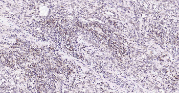 PI3-kinase p110 subunit beta Recombinant Rabbit Monoclonal Antibody