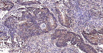 PI3-kinase p110 subunit beta Recombinant Rabbit Monoclonal Antibody