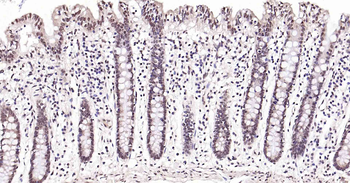 PI3-kinase p110 subunit beta Recombinant Rabbit Monoclonal Antibody