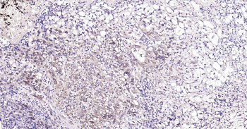 PI3-kinase p110 subunit beta Recombinant Rabbit Monoclonal Antibody